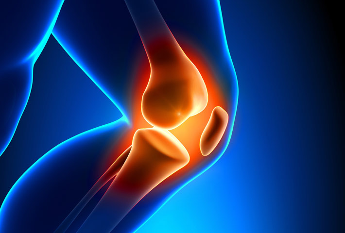 Artrosi, una cura efficace